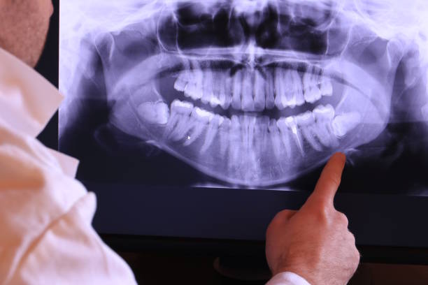 Best Urgent Care for Lost Fillings or Crowns in Pembroke, NC