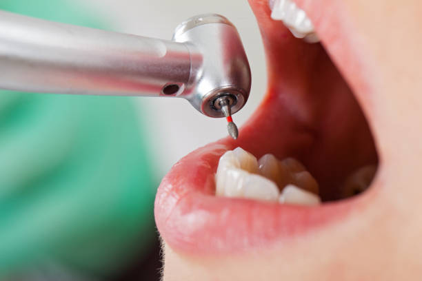 Best Cosmetic Emergency Dentistry in Pembroke, NC